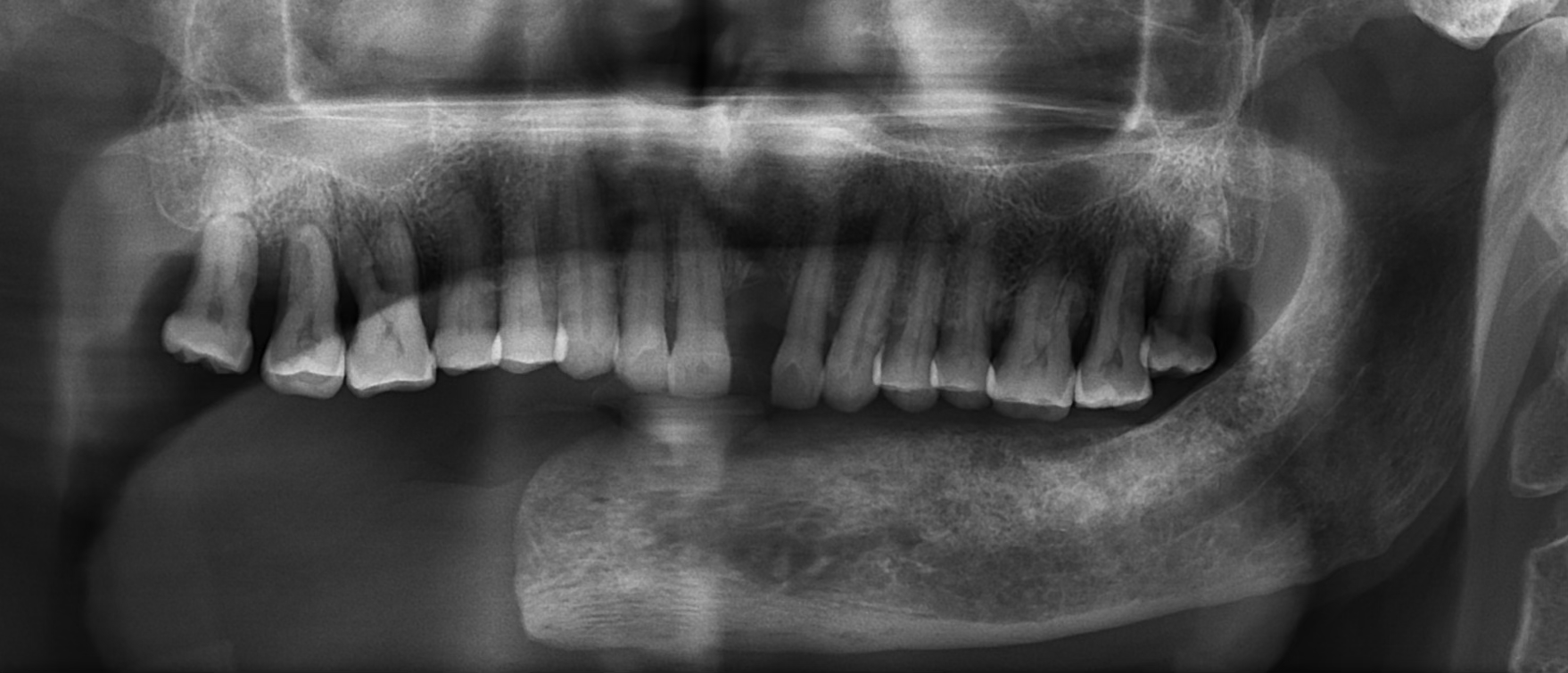 Initial Consultation and Diagnosis